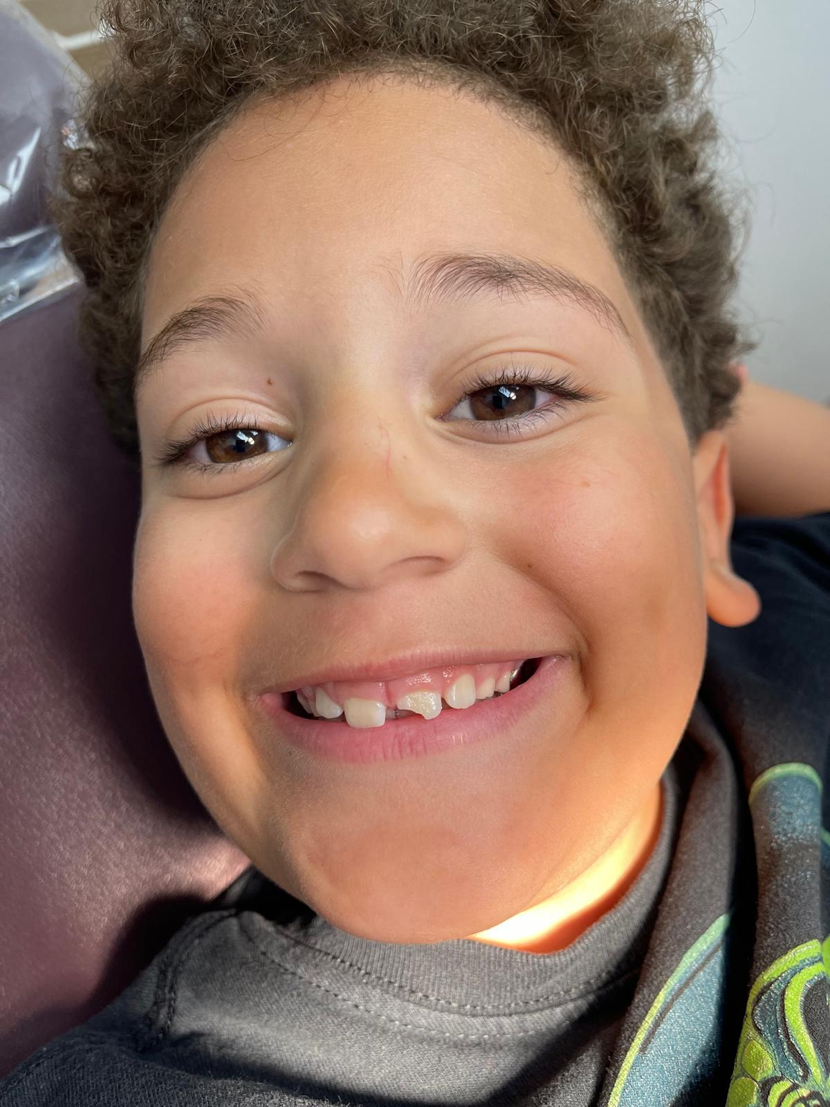 Pediatric dentistry — before